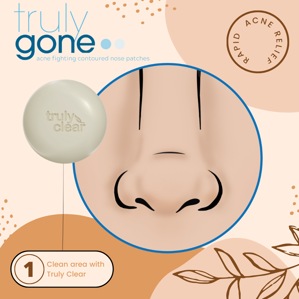 Truly Clear Contoured Nose Patches